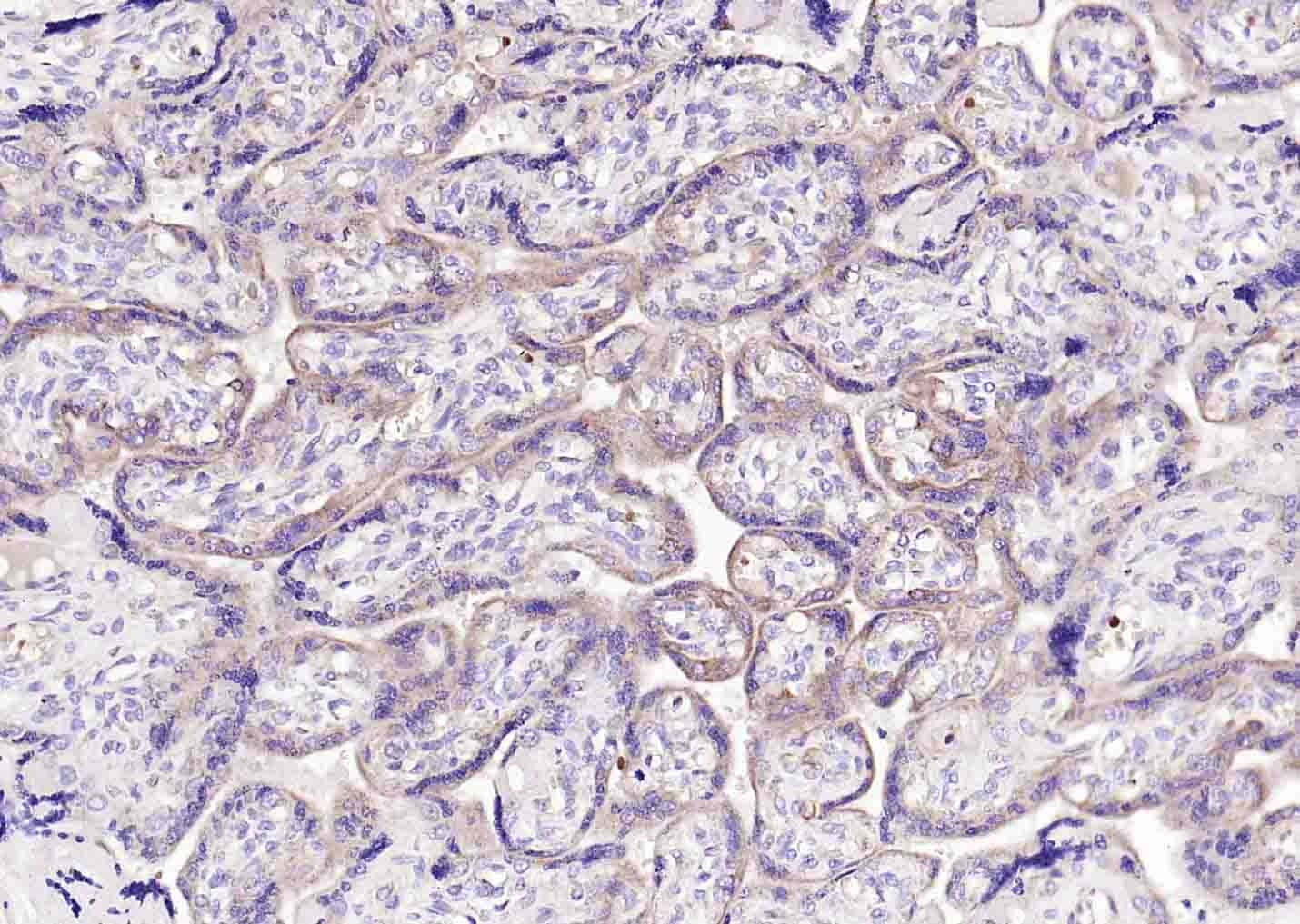 Anti-DIO2 Polyclonal Antibody