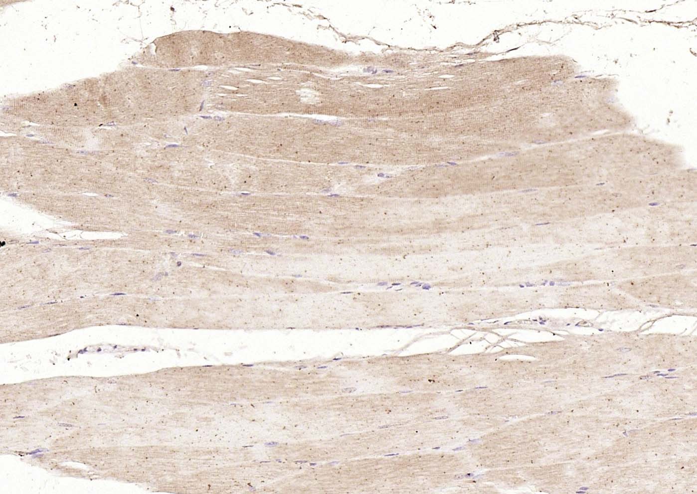 Anti-DLST Polyclonal Antibody