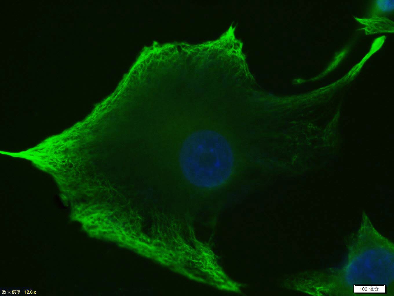 Anti-Vimentin Polyclonal Antibody 3