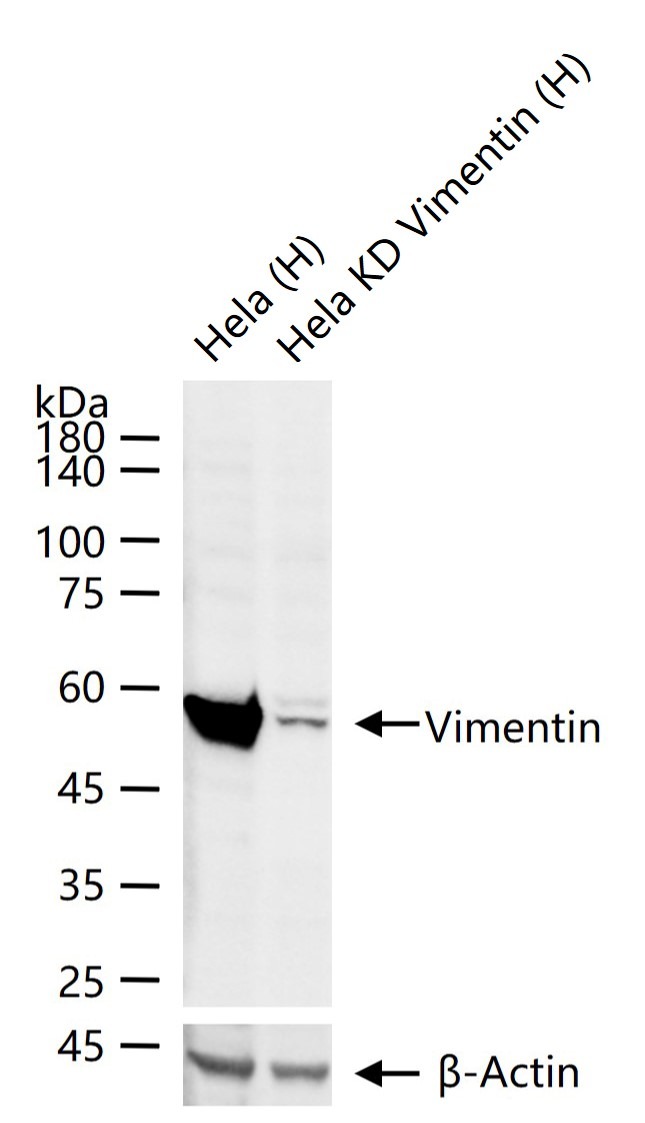 Anti-Vimentin Polyclonal Antibody 2