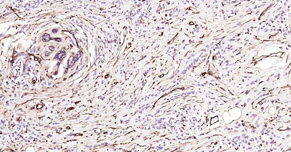 Anti-Vimentin Polyclonal Antibody 2