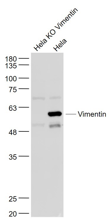 Anti-Vimentin Polyclonal Antibody 3