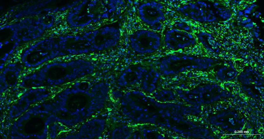 Anti-Vimentin Polyclonal Antibody