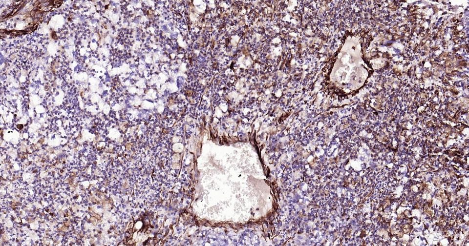 Anti-Vimentin Polyclonal Antibody
