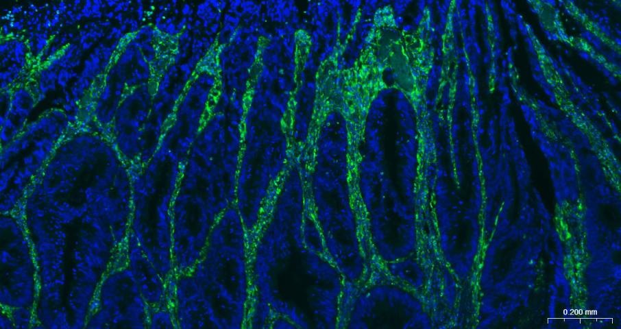 Anti-Vimentin Polyclonal Antibody 2