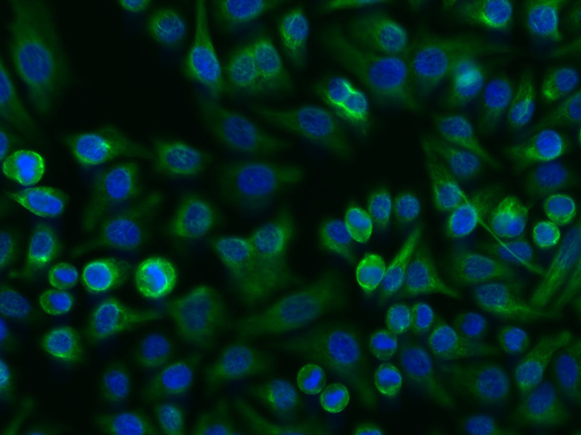Anti-Vimentin Polyclonal Antibody 3