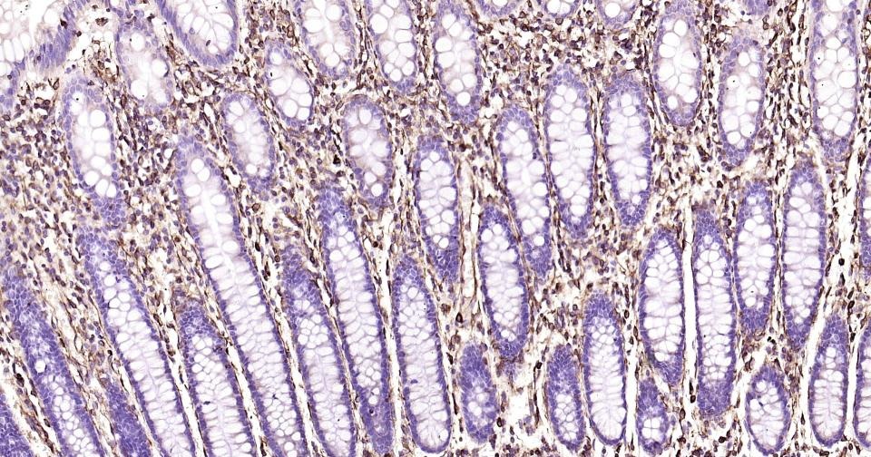 Anti-Vimentin Polyclonal Antibody 2