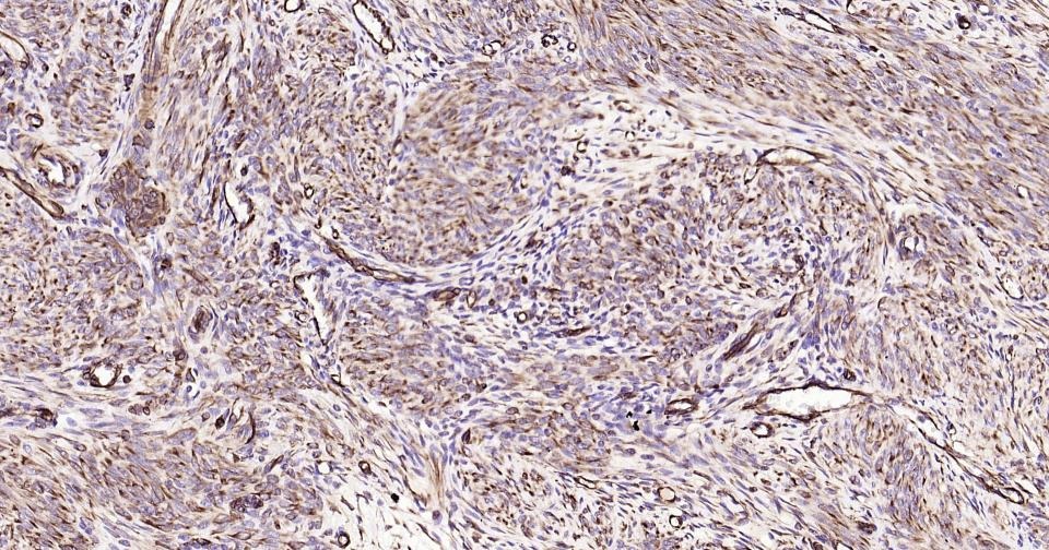Anti-Vimentin Polyclonal Antibody 2