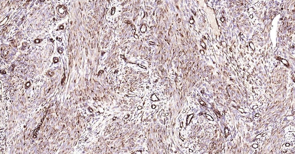 Anti-Vimentin Polyclonal Antibody 3