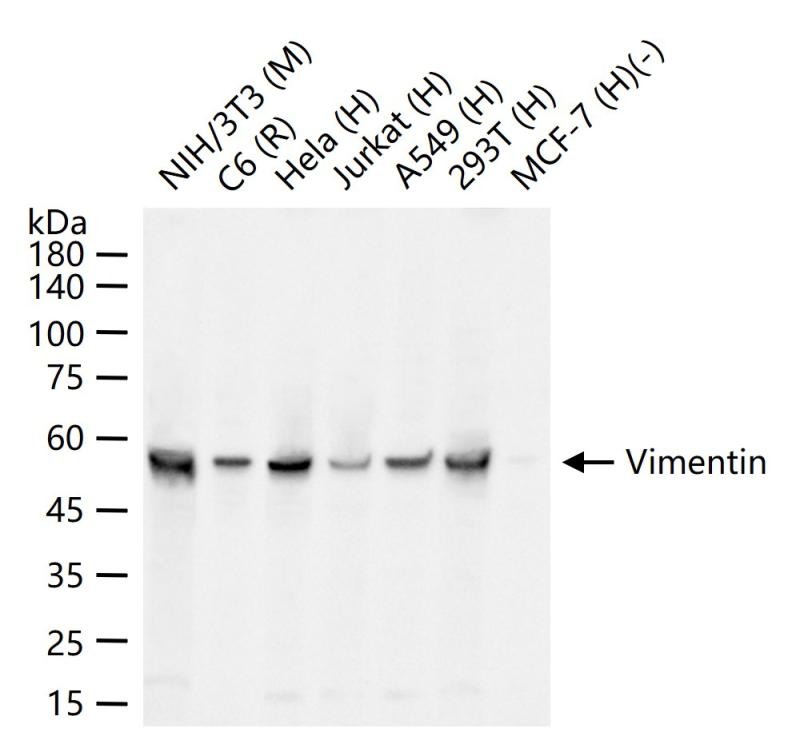 Anti-Vimentin Polyclonal Antibody