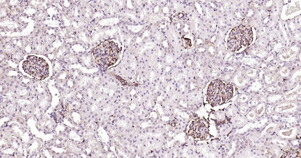 Anti-Vimentin Polyclonal Antibody