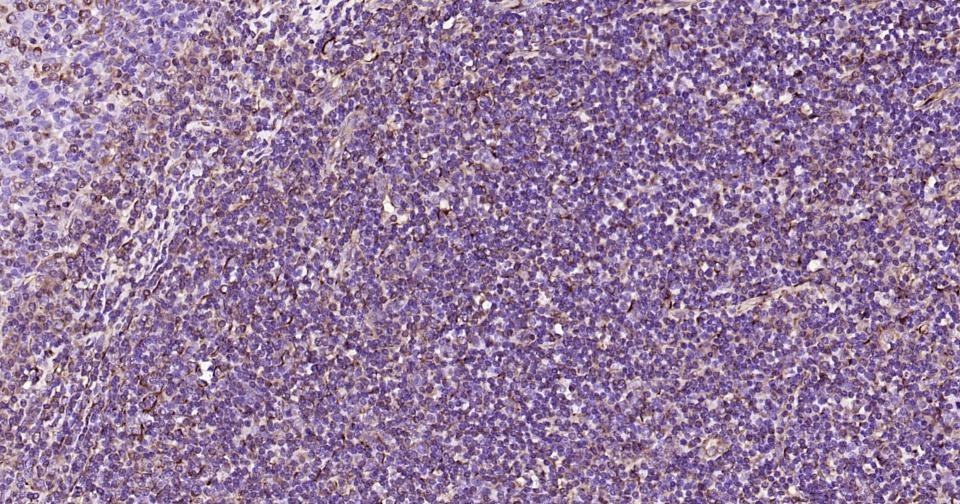 Anti-Vimentin Polyclonal Antibody 2