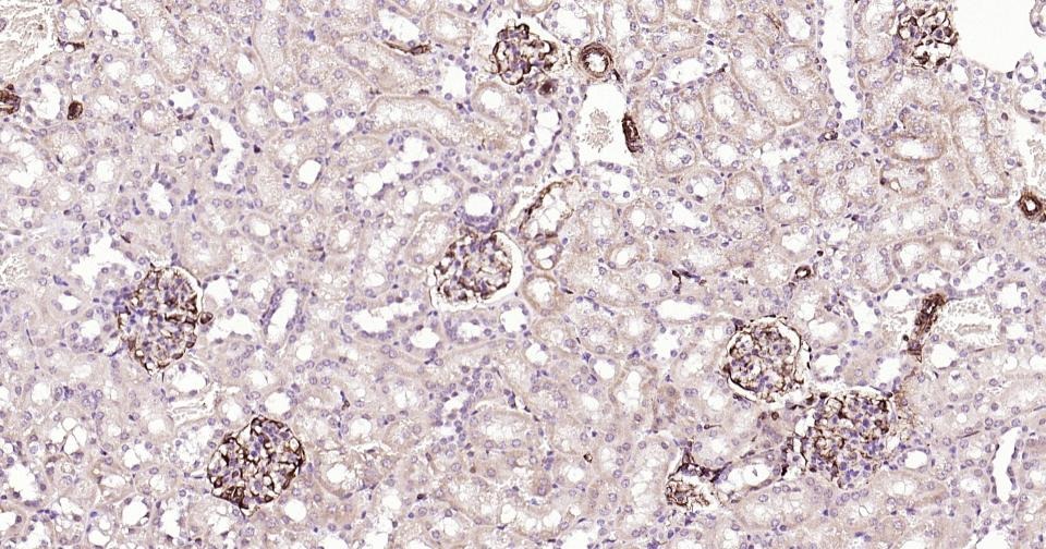 Anti-Vimentin Polyclonal Antibody