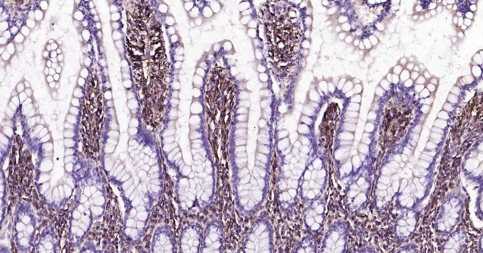Anti-Vimentin Polyclonal Antibody