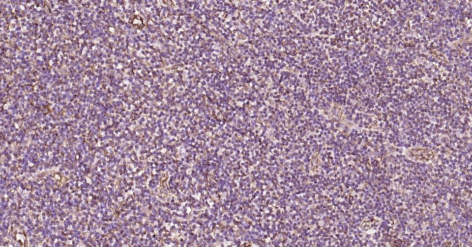 Anti-Vimentin Polyclonal Antibody