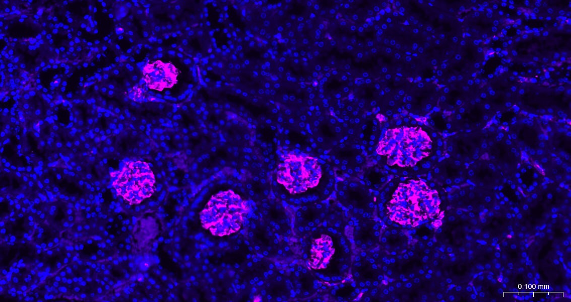 Anti-Vimentin Polyclonal Antibody 3