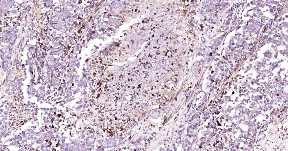Anti-Vimentin Polyclonal Antibody 3