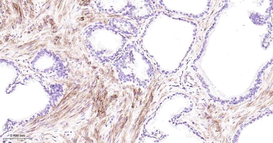 Vinculin Loading Control Antibody (5P889)