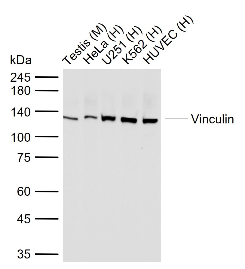 Vinculin Loading Control Antibody (5P889)