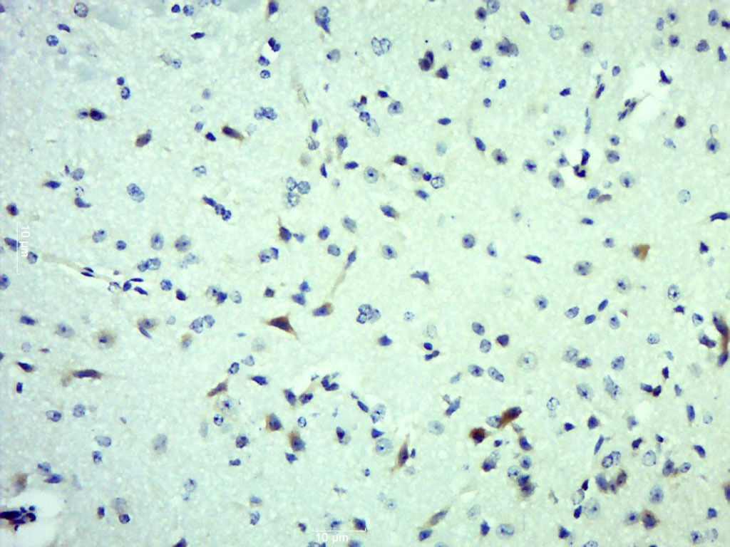 Anti-Von Willebrand Factor/vWF Polyclonal Antibody