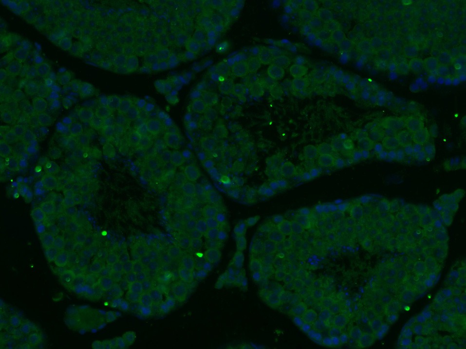 Anti-Wilms tumor/WT1 Polyclonal Antibody