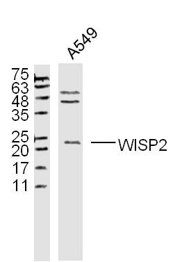 Anti-WISP2/CCN5 Polyclonal Antibody