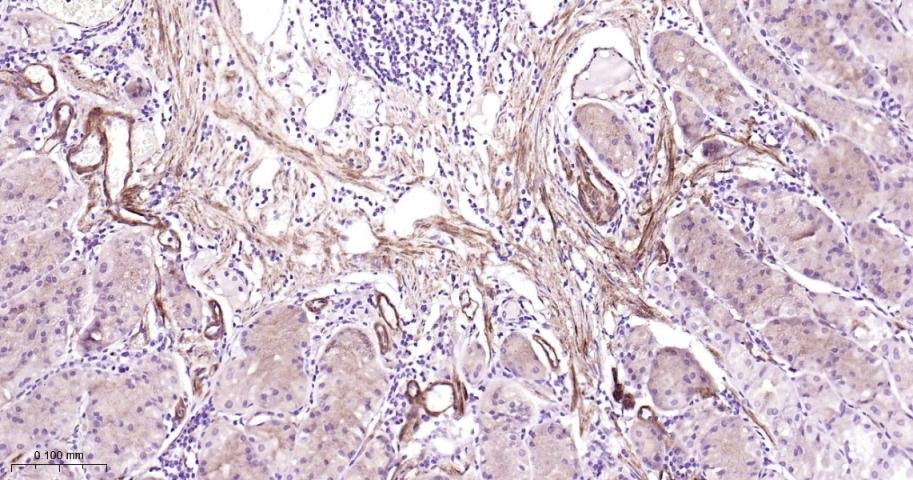 Vinculin Loading Control Antibody (5P889)