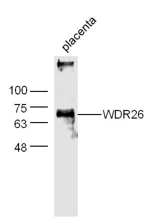 Anti-WDR26 Polyclonal Antibody