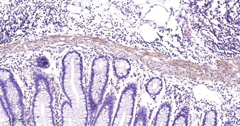Vinculin Loading Control Antibody (5P889)