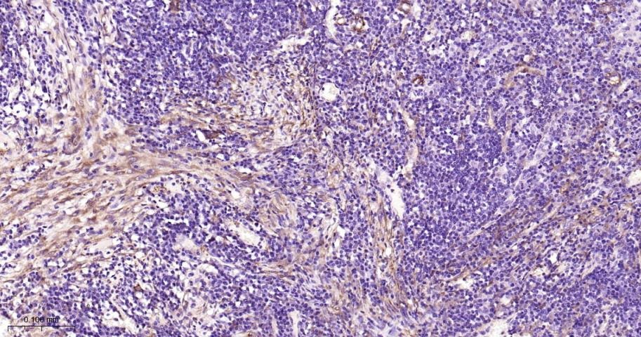 Vinculin Loading Control Antibody (5P889)