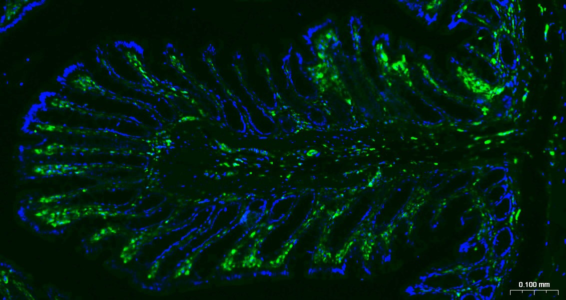 Anti-Vimentin Polyclonal Antibody 3