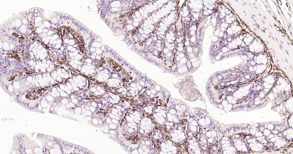 Anti-Vimentin Polyclonal Antibody 3