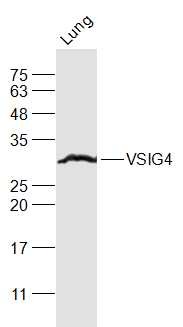 Anti-VSIG4 Polyclonal Antibody