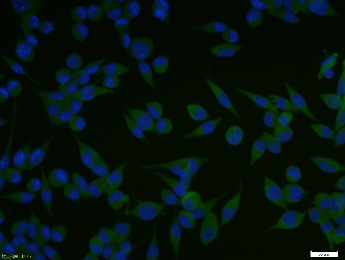 Anti-Vitamin D Receptor/VDR Polyclonal Antibody 2