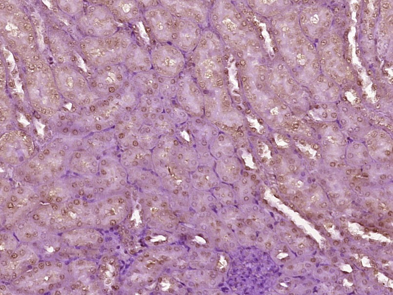 Anti-Wilms tumor/WT1 Polyclonal Antibody