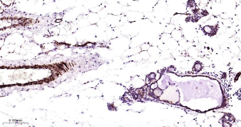 Vinculin Loading Control Antibody (5P889)