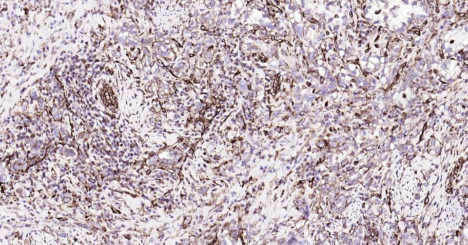 Anti-Vimentin Polyclonal Antibody 3