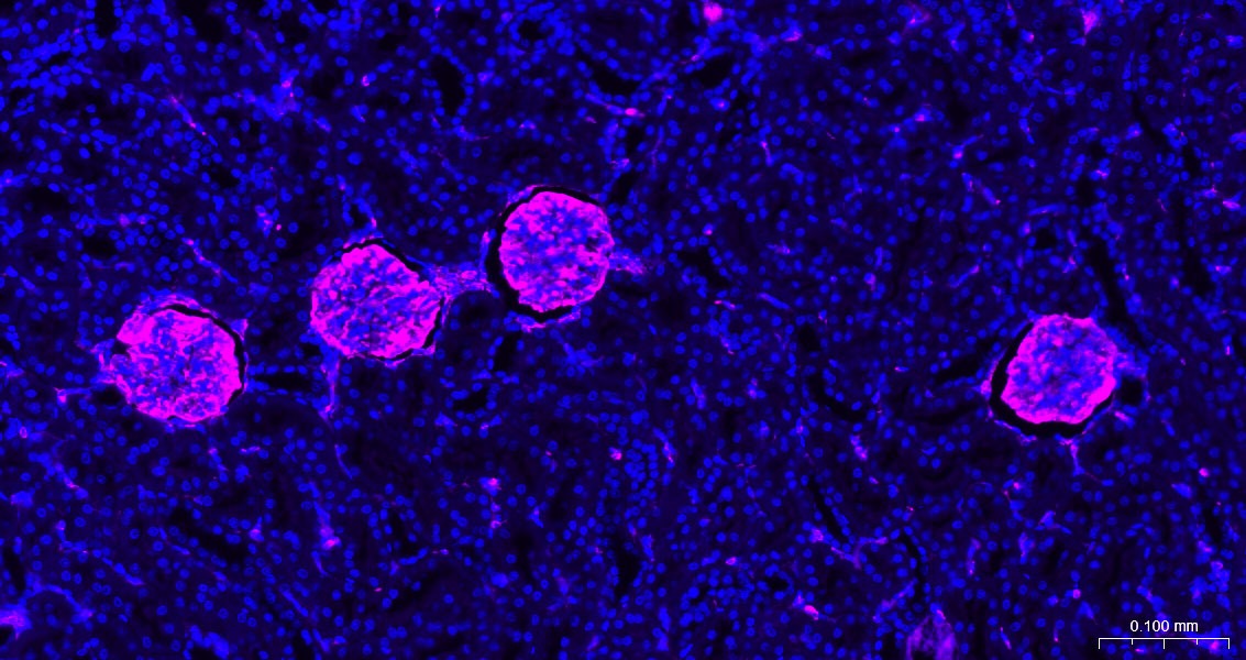 Anti-Vimentin Polyclonal Antibody 3