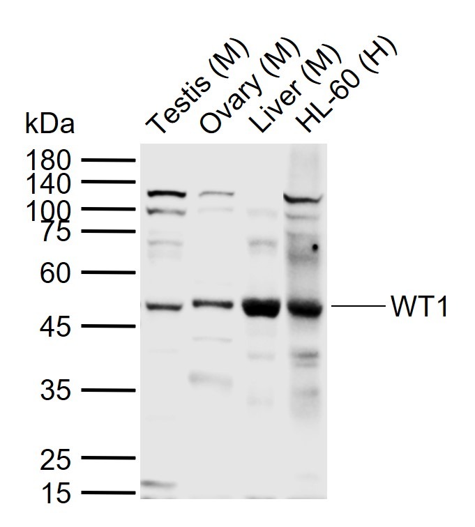 Anti-Wilms tumor/WT1 Polyclonal Antibody
