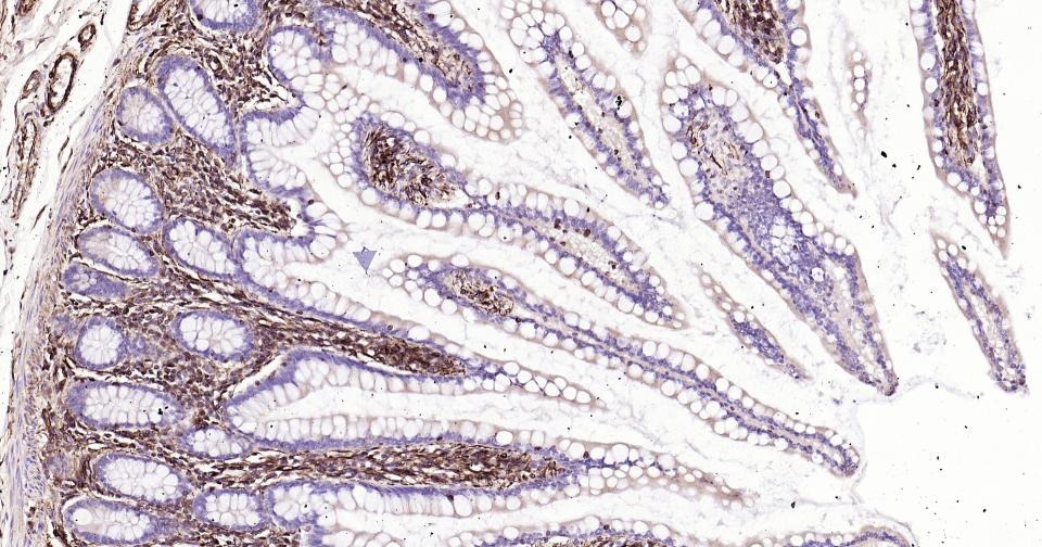 Anti-Vimentin Polyclonal Antibody 3