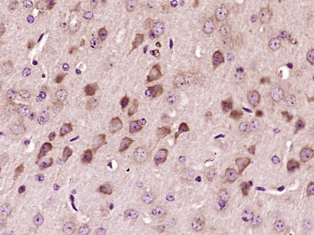 Anti-Von Willebrand Factor/vWF Polyclonal Antibody 2