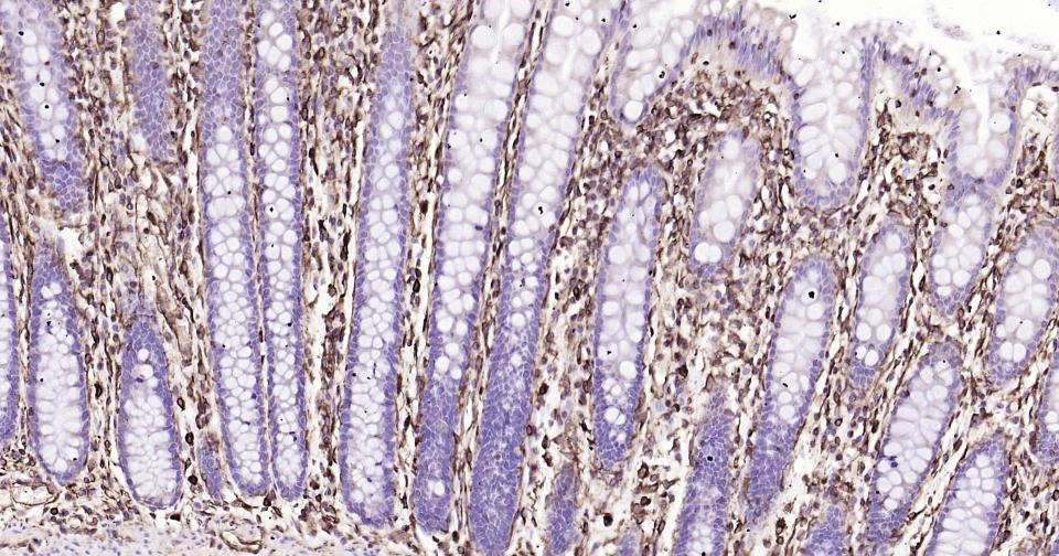 Anti-Vimentin Polyclonal Antibody 3