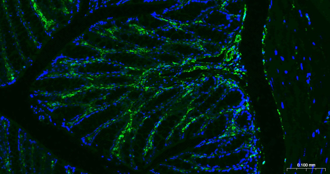 Anti-Vimentin Polyclonal Antibody 3