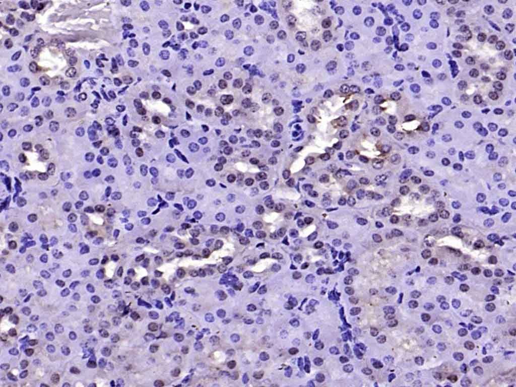 Anti-FAK Polyclonal Antibody 2