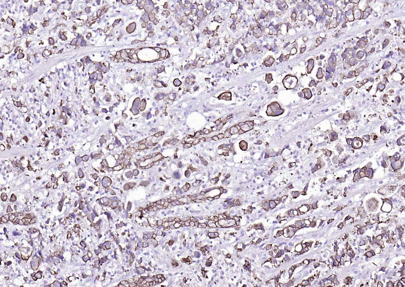 Anti-Cytokeratin 8 Antibody (5G219)