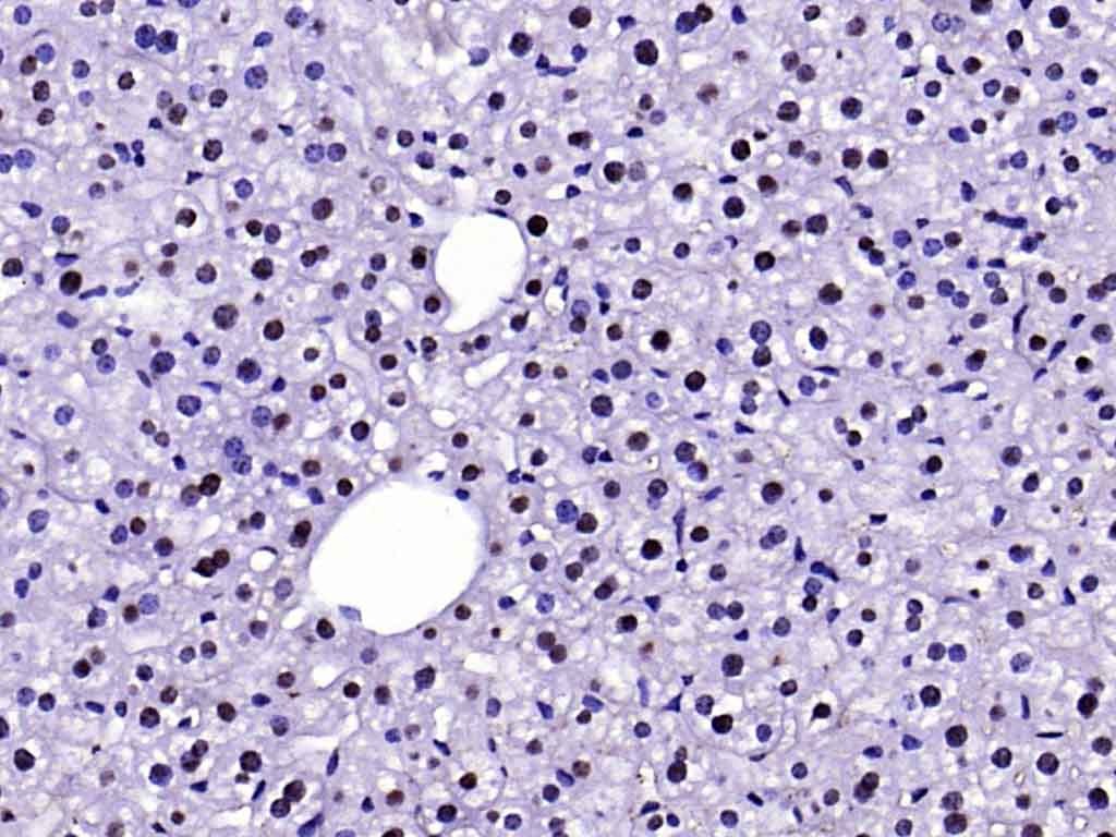 Anti-FAK Polyclonal Antibody 2
