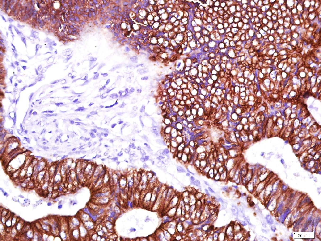 Anti-Cytokeratin 8 Antibody (5G219)