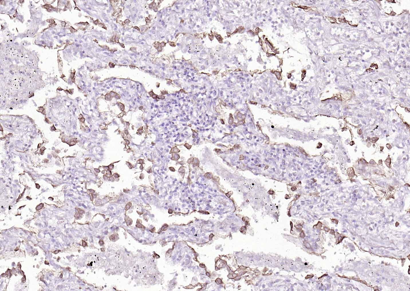 Anti-Cytokeratin 8 Antibody (5G219)