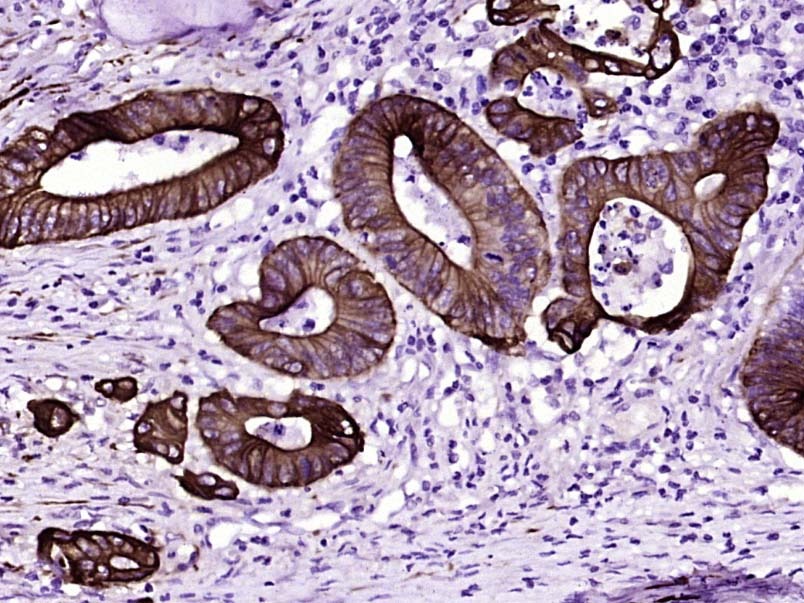 Anti-Cytokeratin 8 Antibody (5G219)
