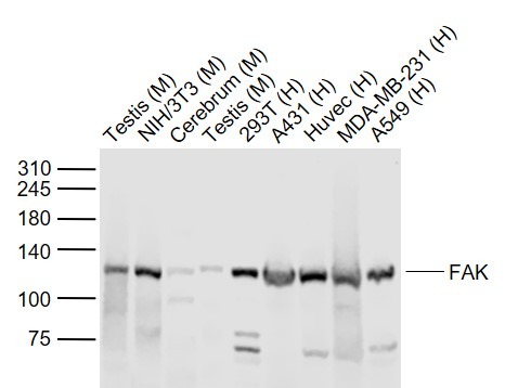 Anti-FAK Polyclonal Antibody 2